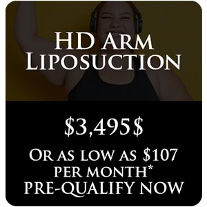 HD Arm Liposuction