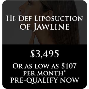 Hi-Def Liposuction of Jawline