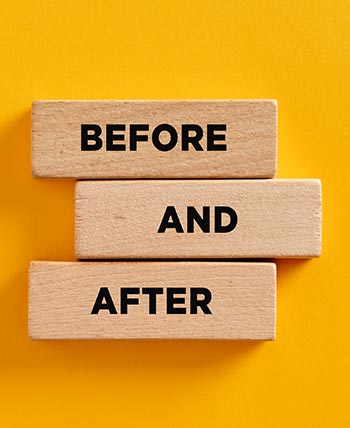 Before and After for Face Works Plastic Surgery, Plastic Surgeon in Schaumburg, IL