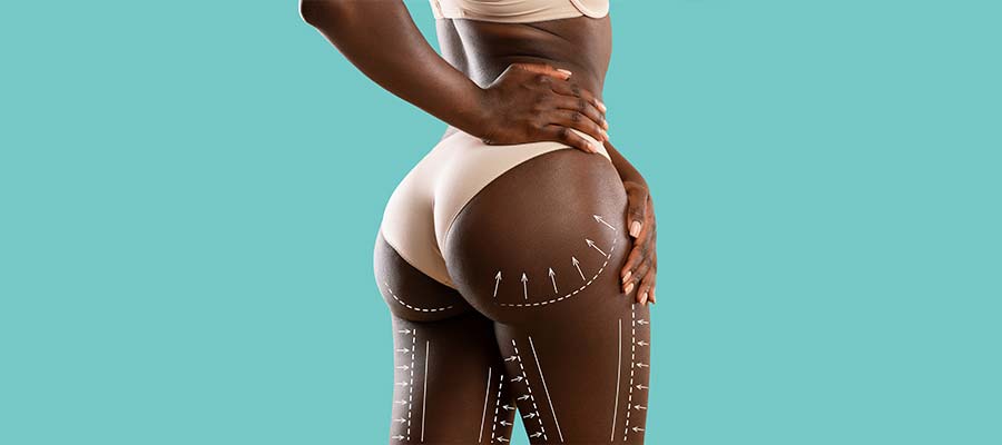 Brazilian Butt Lift Specialist Near Me in Schaumburg IL