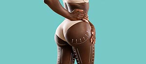 Brazilian Butt Lift Specialist Near Me in Schaumburg IL