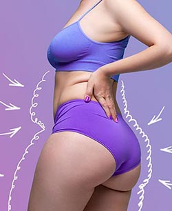 Cellulite Treatment Near Me in Schaumburg, IL
