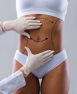 Cellulite Treatment by Aveli Near Me in Schaumburg, IL