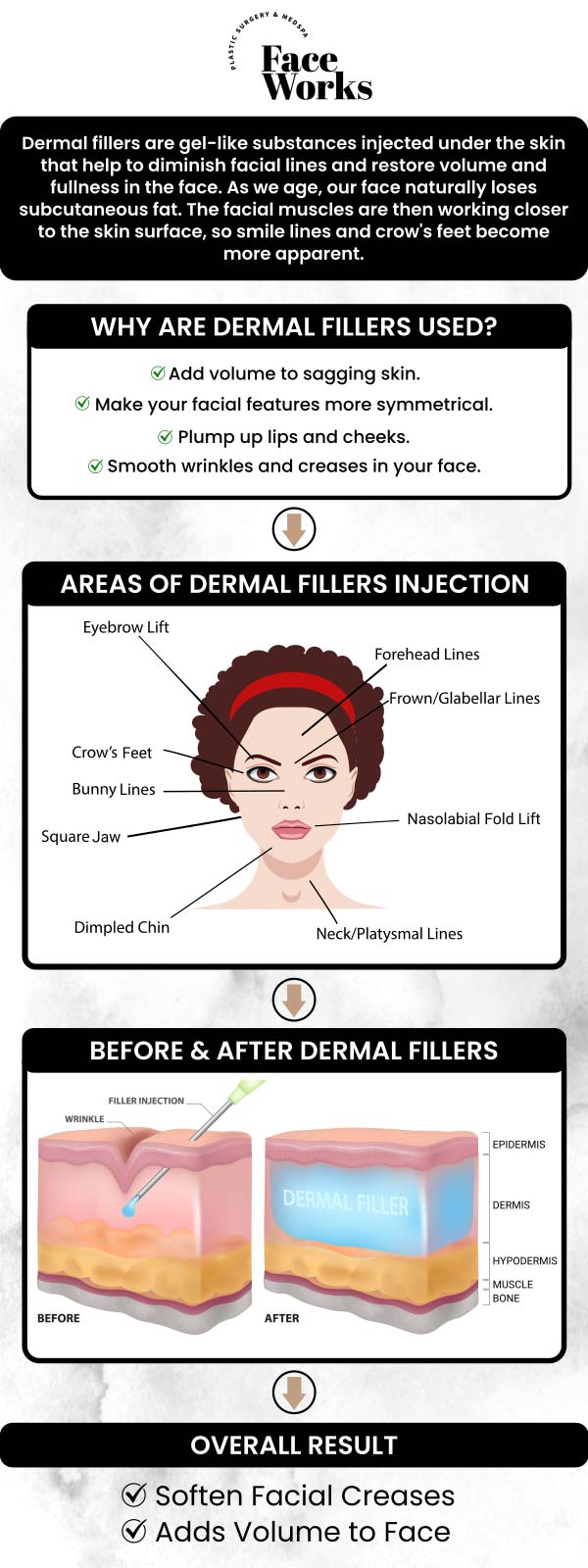 Dr. Paul C. Dillon, M.D., at Face Works Plastic Surgery is a trusted dermal fillers specialist, offering customized treatments to restore volume and smooth out wrinkles. With his expertise, Dr. Dillon enhances facial features, giving patients a more youthful, refreshed appearance with results that look natural and radiant. For more information, contact us or book an appointment online. We are conveniently located at 501 W Golf Rd A, Schaumburg, IL 60195. Dr. Paul C. Dillon, M.D., at Face Works Plastic Surgery is a trusted dermal fillers specialist, offering customized treatments to restore volume and smooth out wrinkles. With his expertise, Dr. Dillon enhances facial features, giving patients a more youthful, refreshed appearance with results that look natural and radiant. For more information, contact us or book an appointment online. We are conveniently located at 501 W Golf Rd A, Schaumburg, IL 60195.