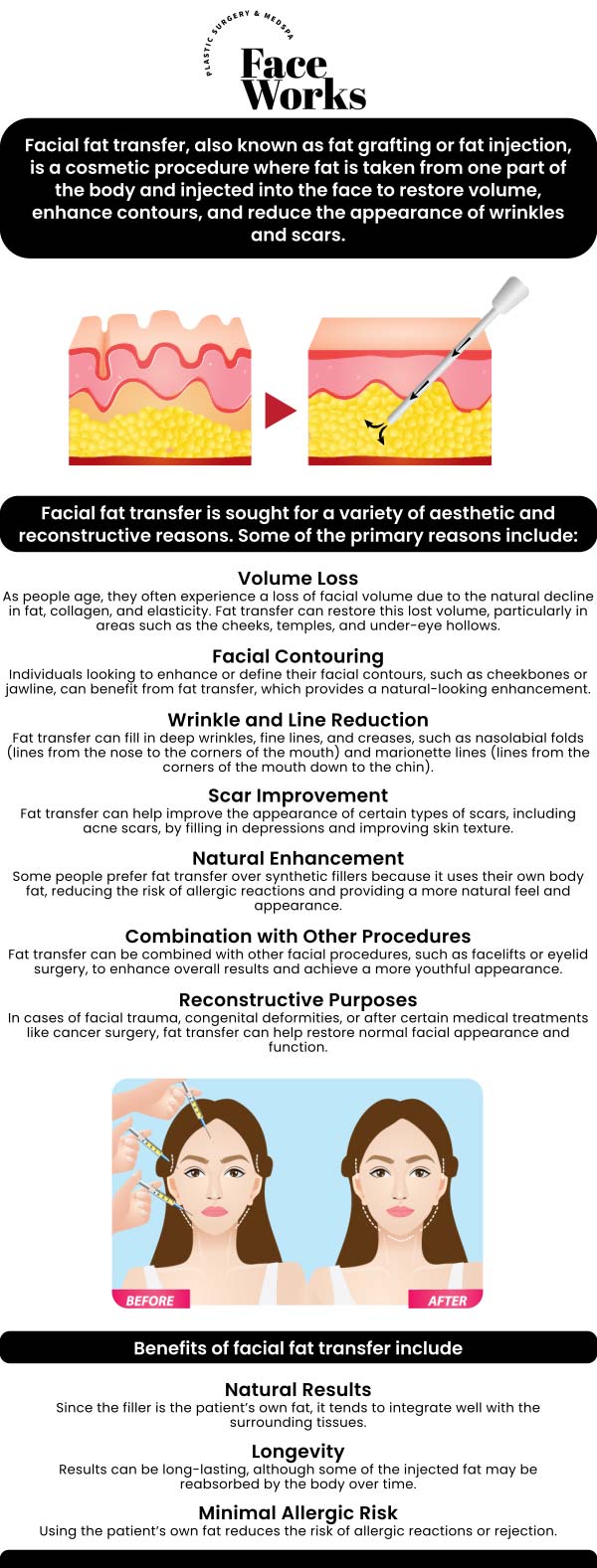 Common questions asked by patients: What is a face fat transfer, and how does the procedure work to add volume and rejuvenate the face? How is the fat purified and prepared for injection into the face? Who is an ideal candidate for a face fat transfer? What kind of results can be realistically achieved with a fat transfer? For more information, contact us or request an appointment online. We serve patients from Schaumburg IL, Hoffman Estates IL, Rolling Meadows IL, Hanover Park IL, Streamwood IL, Elk Grove Village IL, and surrounding areas.