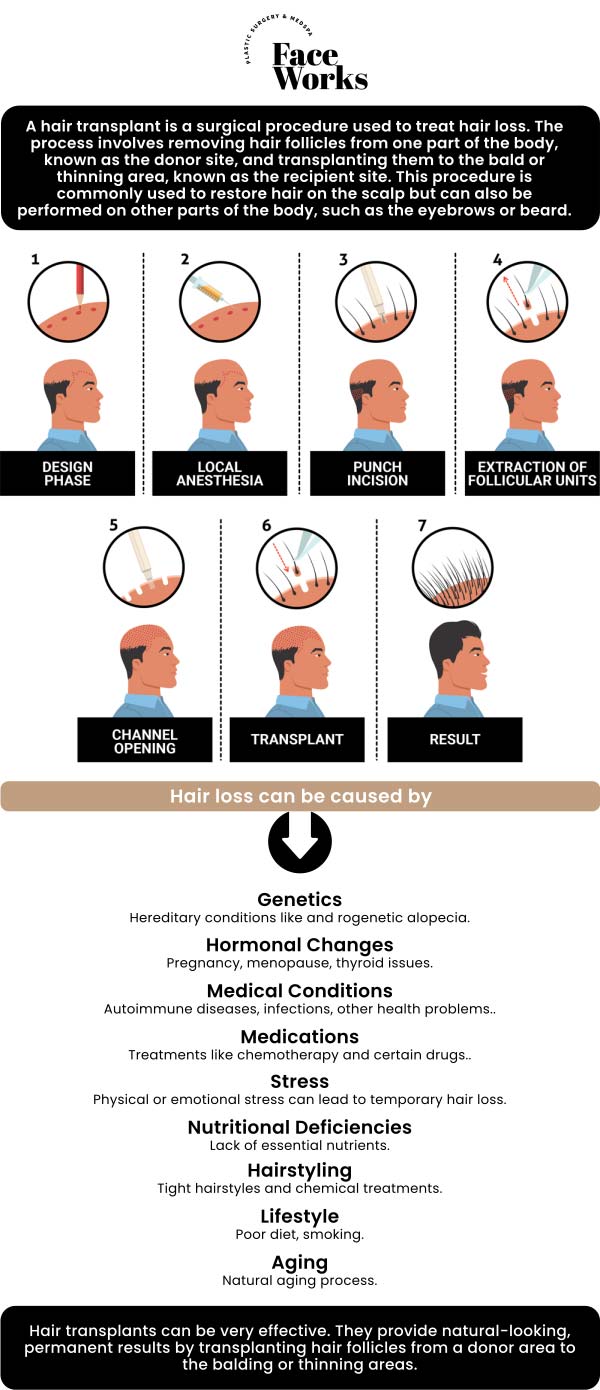 Common questions asked by patients: What is a FUE hair transplant? How is the FUE procedure performed? What are the key steps from start to finish? How are the harvested follicles preserved and then implanted into the recipient area? Who is an ideal candidate for a FUE hair transplant? For more information, contact us or request an appointment online. We serve patients from Schaumburg IL, Hoffman Estates IL, Rolling Meadows IL, Hanover Park IL, Streamwood IL, Elk Grove Village IL, and surrounding areas.