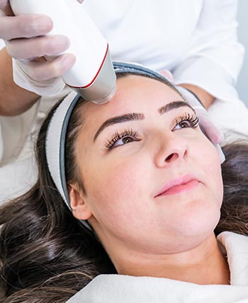 Microneedling + Exosome Near Me in Schaumburg, IL
