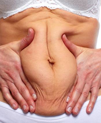 Non-Surgical Near Me in Schaumburg, IL
