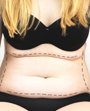 Surgical Under Anesthesia Near Me in Schaumburg, IL