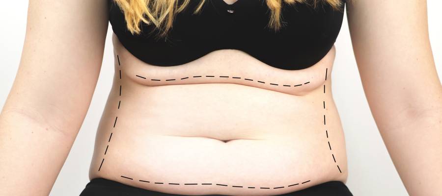 Surgical Under Anesthesia in Schaumburg, IL