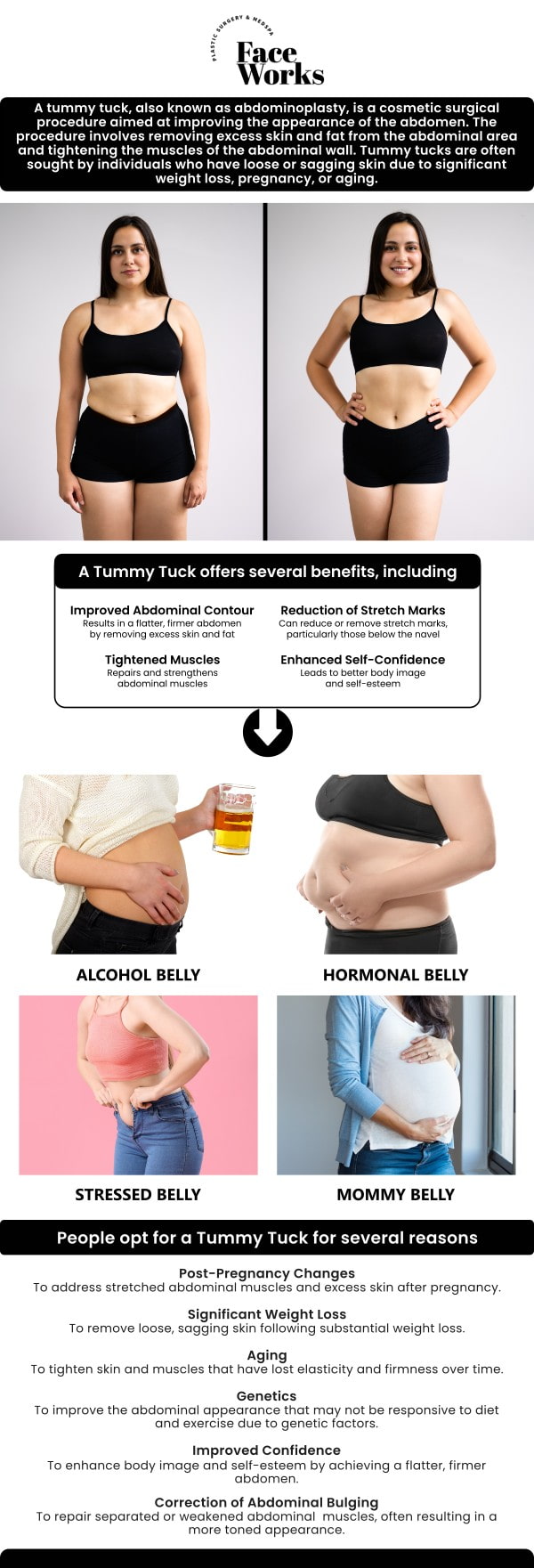 At Face Works Plastic Surgery, our skilled team offers expert mini tummy tuck procedures to help you achieve a firmer, flatter abdomen with minimal downtime. We specialize in contouring the lower abdominal area by removing excess skin and tightening underlying muscles. Ideal for individuals with mild to moderate abdominal concerns, our approach delivers natural-looking results with a shorter recovery period. For more information, contact us or request an appointment online. We are conveniently located at 501 W Golf Rd A, Schaumburg, IL 60195.