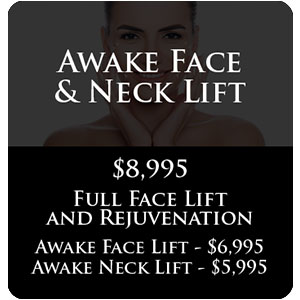 Awake Face & Neck Lift