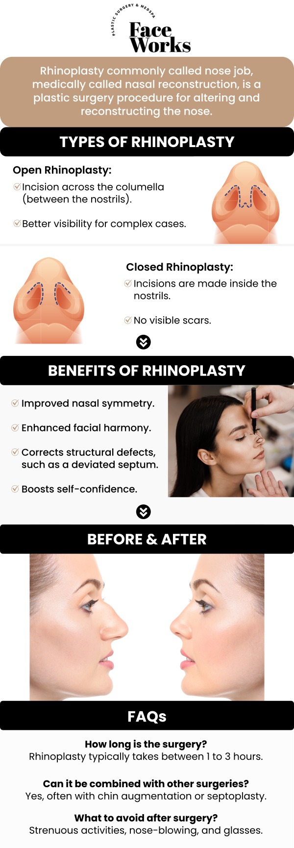 At FaceWorks, our team of providers in Schaumburg, IL, is dedicated to providing personalized care and achieving natural-looking results. Whether you're seeking to enhance the aesthetic of your nose or improve function, we use advanced techniques tailored to your unique needs. Our skilled surgeons prioritize both form and function, ensuring optimal results with minimal recovery time. For more information, contact us or request an appointment online. We are conveniently located at 501 W Golf Rd A, Schaumburg, IL 60195.