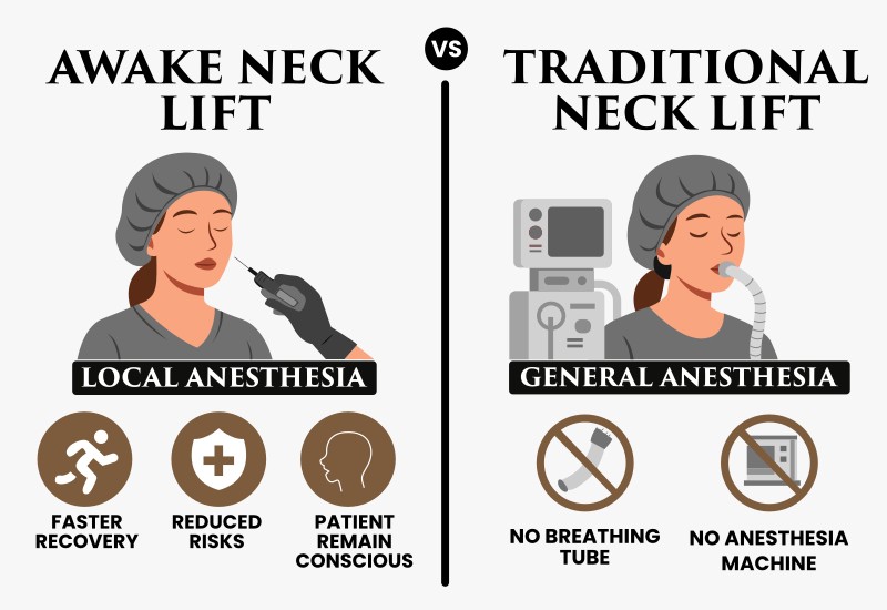 Awake Face Lift VS Traditional Neck Lift Awake Face Lift VS Traditional Neck Lift