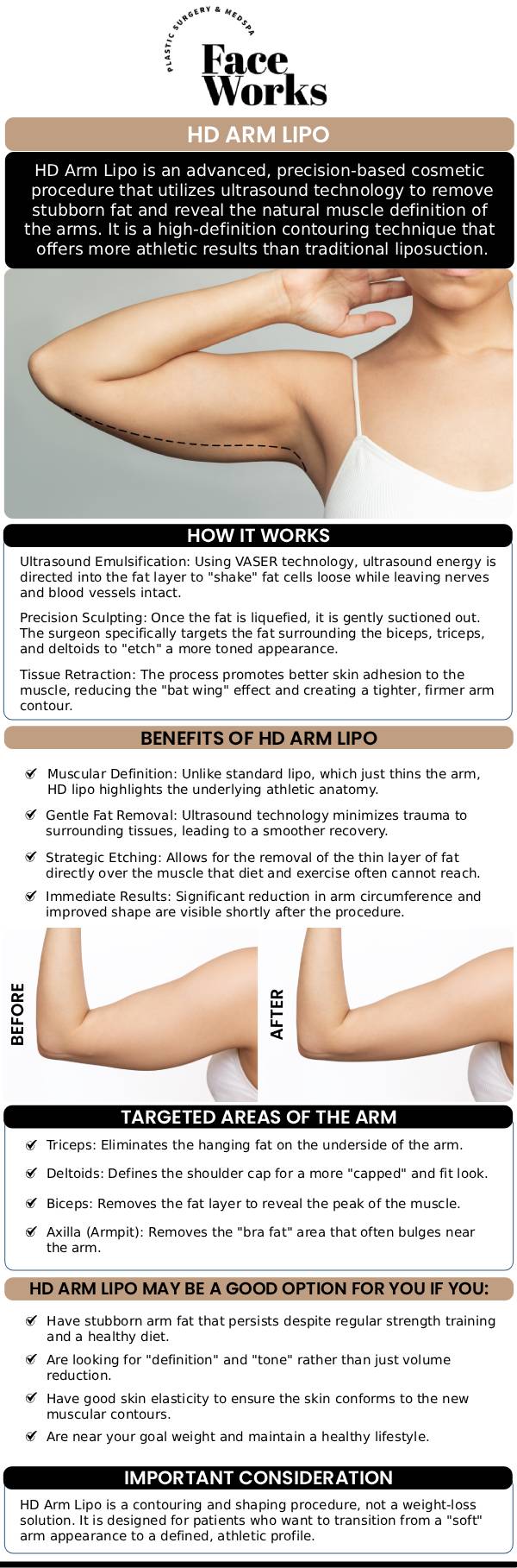 At FaceWorks, we believe that beautiful arms aren't just about losing volume—they’re about revealing the underlying muscle architecture. Our HD Arm Lipo 360 approach goes beyond traditional liposuction by treating the arm as a three-dimensional cylinder. We meticulously sculpt the shoulder (deltoid) transition, the triceps area, and the bicep curvature to eliminate "bat wings" while highlighting athletic definition. For more information, contact us or book an appointment online. We are conveniently located at 501 W Golf Rd A, Schaumburg, IL 60195.