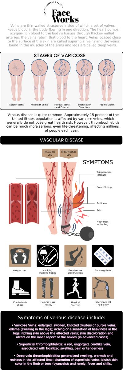 Common questions asked by clients: What are varicose veins and what causes them? How is a phlebectomy different from other vein treatments? Is the procedure painful? Will my varicose veins come back after treatment? For more information, contact us or request an appointment online. We serve patients from Schaumburg IL, Hoffman Estates IL, Rolling Meadows IL, Hanover Park IL, Streamwood IL, Elk Grove Village IL, and surrounding areas.