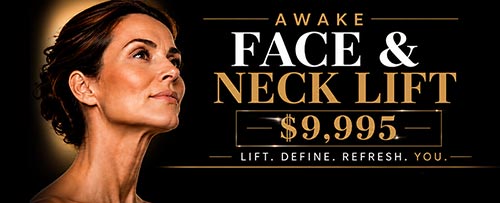Awake Face & Neck Lift $9,995