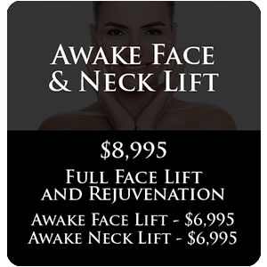 Awake Face & Neck Lift