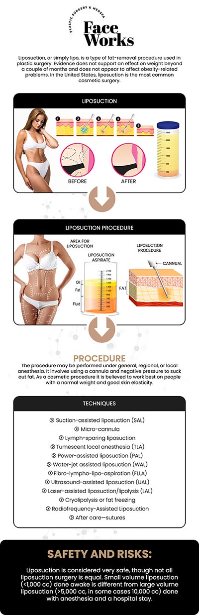 At Face Works Plastic Surgery, our dedicated team is proud to offer advanced awake body liposuction to help you eliminate stubborn fat and achieve your desired aesthetic goals safely. This minimally invasive approach utilizes local anesthesia, allowing you to remain completely comfortable and conscious while we meticulously sculpt your body. For more information, contact us or book an appointment online. We are conveniently located at 501 W Golf Rd A, Schaumburg, IL 60195.