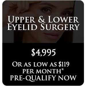 Upper & Lower Eyelid Surgery Upper & Lower Eyelid Surgery