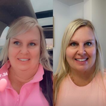 Two women before and after weight loss